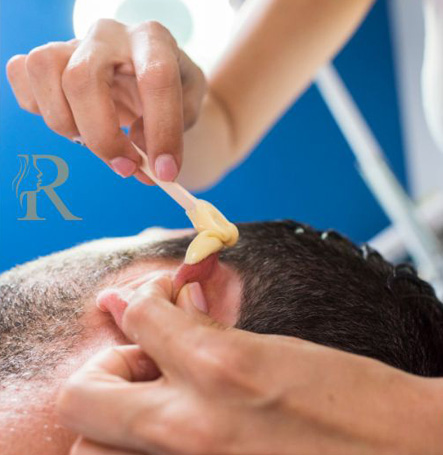 Men Ear Wax